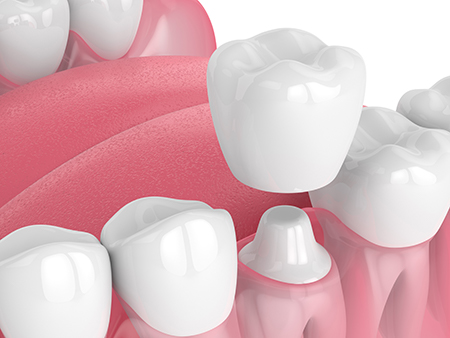 Myron Fishbein Family Dentistry